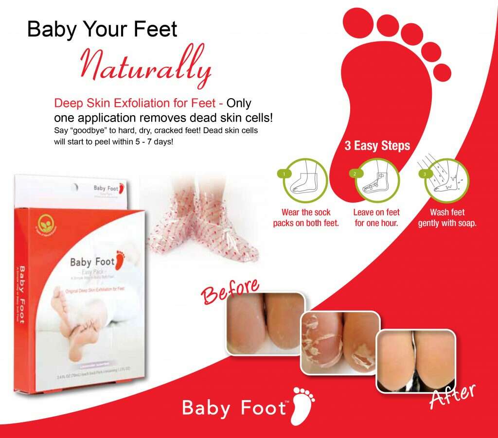 Baby Foot: A Chemical Peel for your Feet!