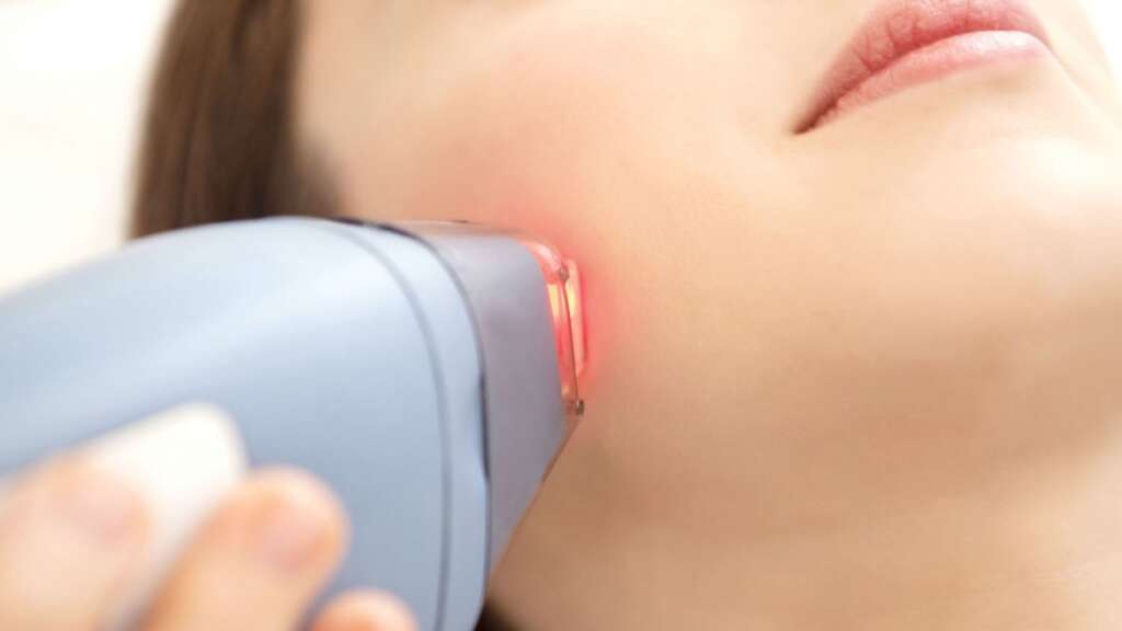 Doctor Performing Laser Hair Removal, IPL (Intense Pulsed Light), Sublative Rejuvenation, Fractional CO2 Laser, Accent (RF)