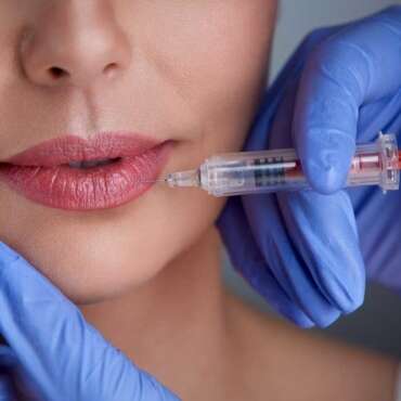 Plump Your Lips with Juvederm Ultra XC